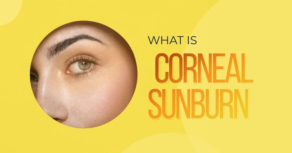 banner image of What is corneal sunburn blog | Global Eye Hospital Hyderabad