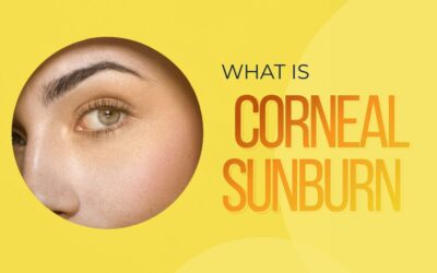 banner image of What is corneal sunburn blog | Global Eye Hospital Hyderabad