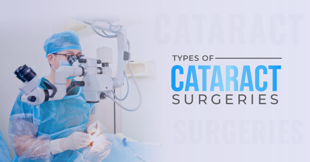 What are different types of cataract surgeries - Global eye hospital