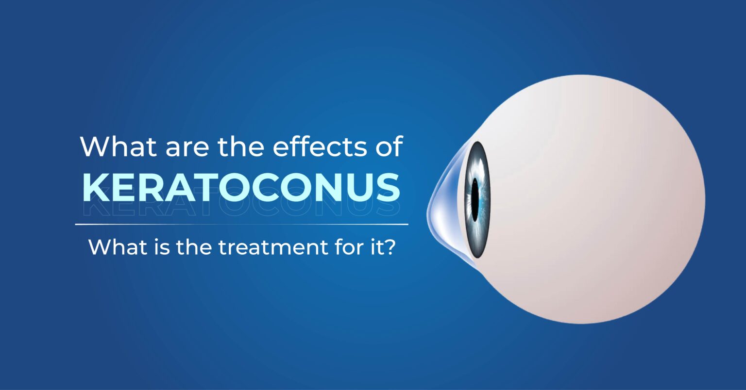 What Are The Effects And Treatment Of Keratoconus 