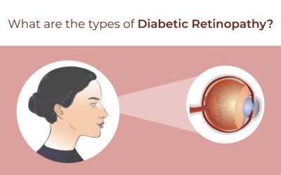 What are the types of diabetic retinopathy - Global Eye Hospital