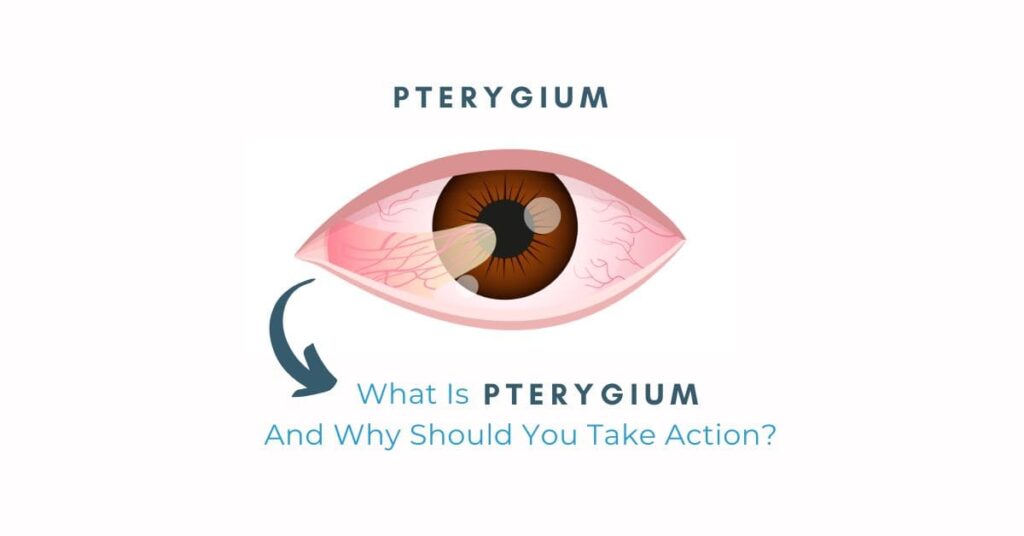 What Is Pterygium, And Why Should You Take Action - Global Eye Hospital