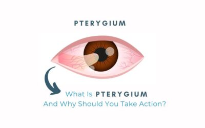 What Is Pterygium, And Why Should You Take Action - Global Eye Hospital