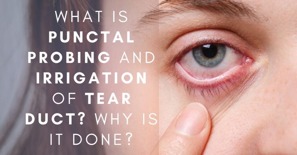 What Is Punctal probing and Irrigation of tear duct? Why Is It Done? - Global Eye Hospital