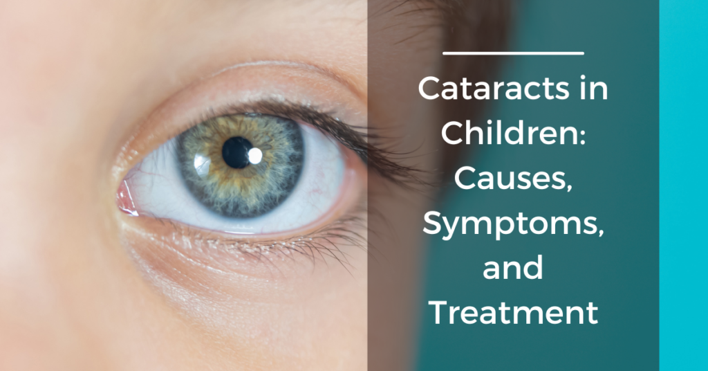 Cataracts in Children Causes, Symptoms, and Treatment - cover photo - Global Eye Hospital