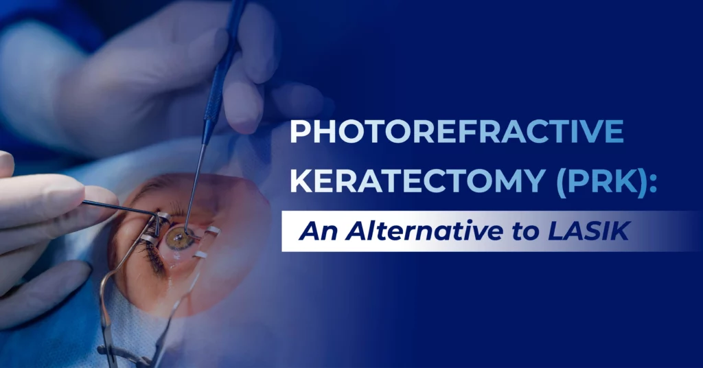 Photorefractive Keratectomy (PRK)An Alternative to LASIK-Gloabl-Eye-Hospital