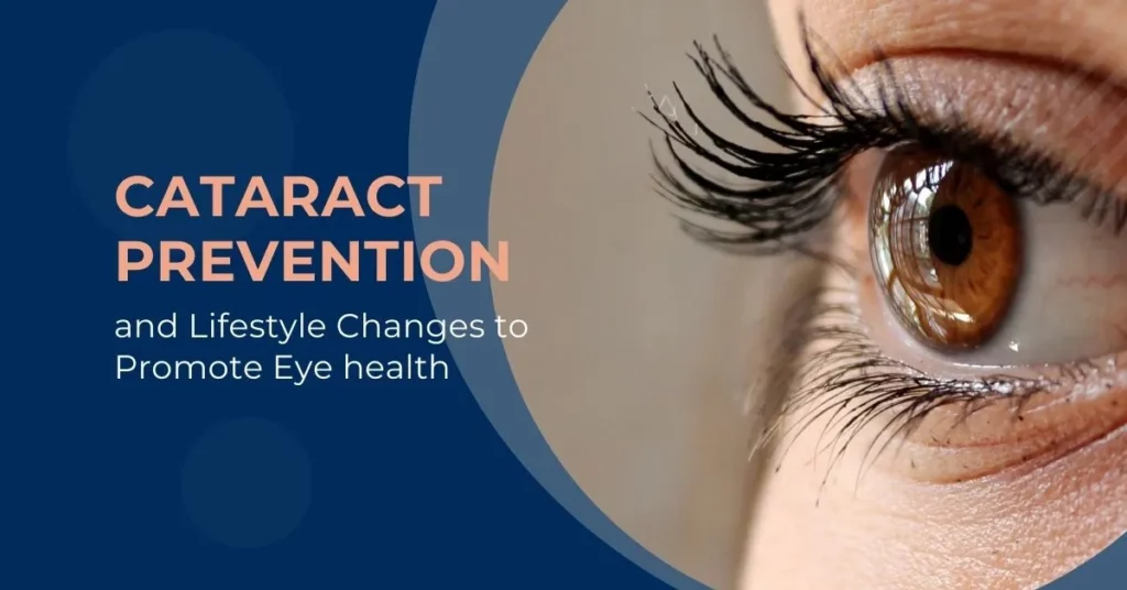 Cataract Prevention and Lifestyle Changes to Promote Eye health - Global Eye Hospital