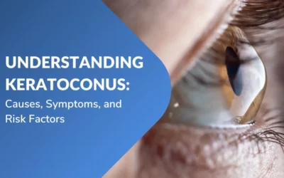 Understanding Keratoconus Causes, Symptoms, and Risk Factors
