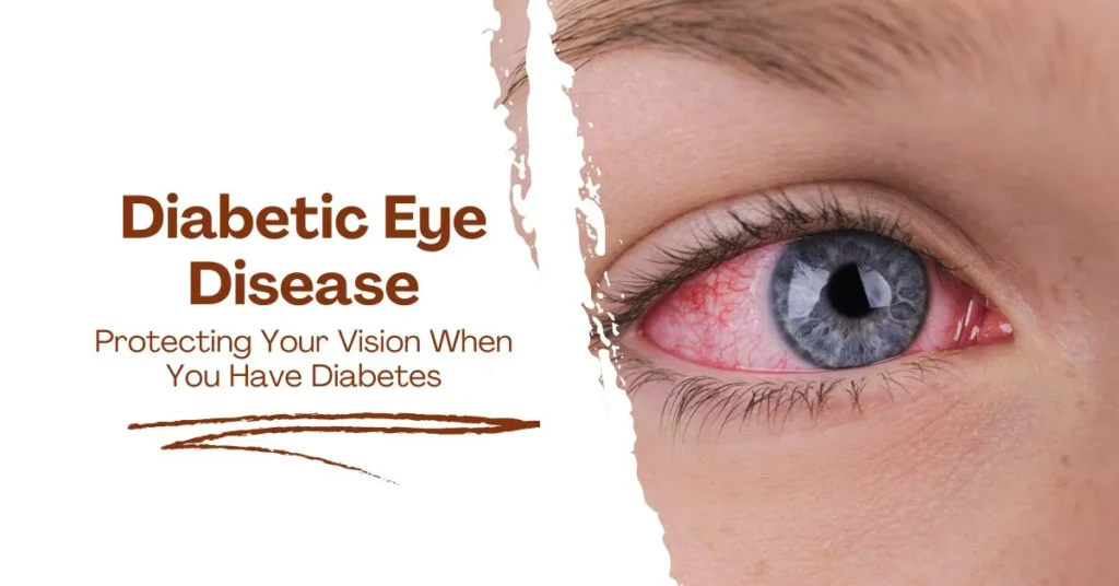 Diabetic Eye Disease Protecting Your Vision When You Have Diabetes - Global Eye Hospital