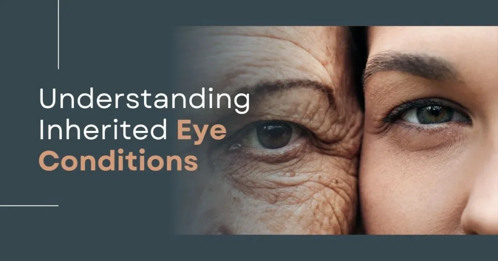 Understanding Inherited Eye Conditions