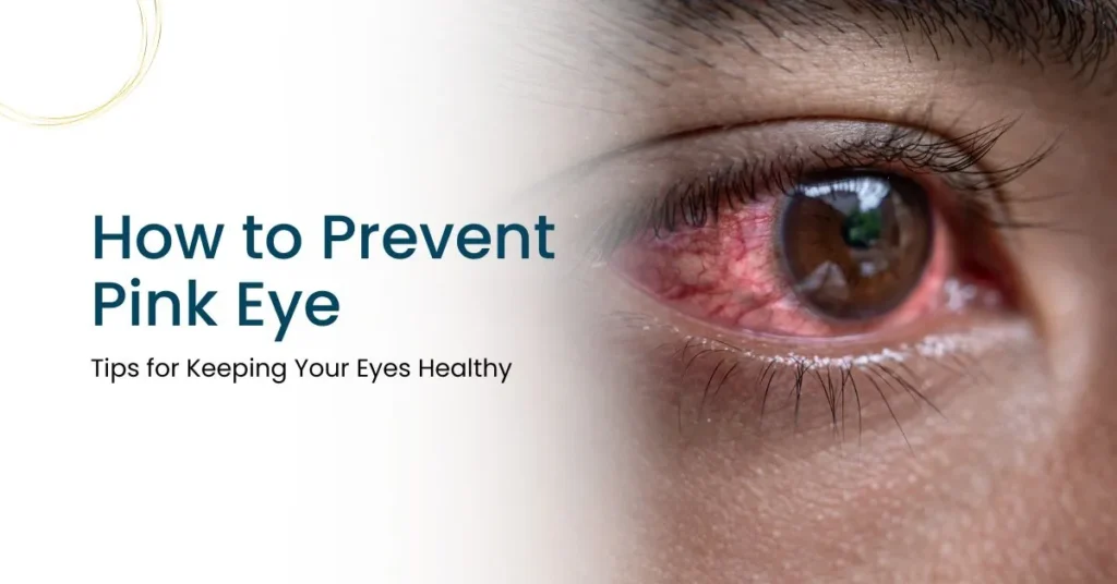 How to Prevent Pink Eye Tips for Keeping Your Eyes Healthy - Global Eye Hospital