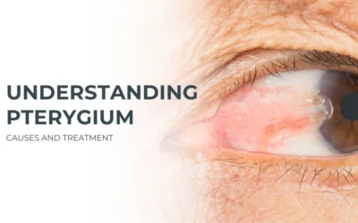 Understanding Pterygium Causes and Treatment - Global Eye Hospital