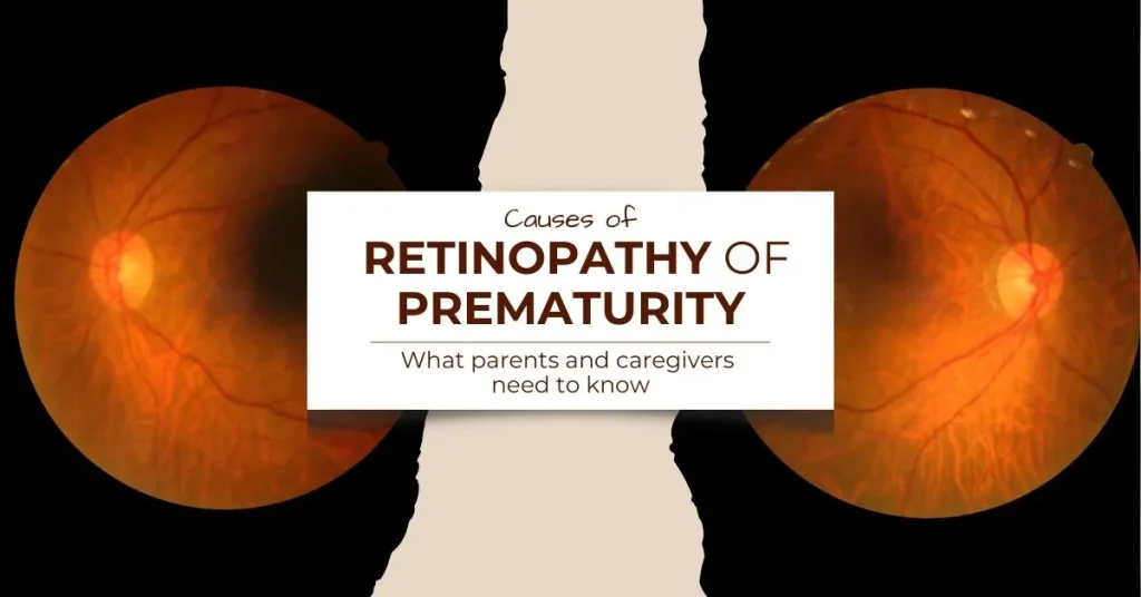 Causes of Retinopathy of Prematurity What Parents and Caregivers Need to Know - Clarity Vision