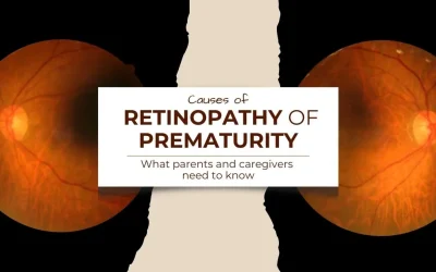 Causes of Retinopathy of Prematurity What Parents and Caregivers Need to Know - Clarity Vision