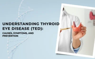 Understanding Thyroid Eye Disease (TED) Causes, Symptoms, and Prevention - Global Eye Hospital